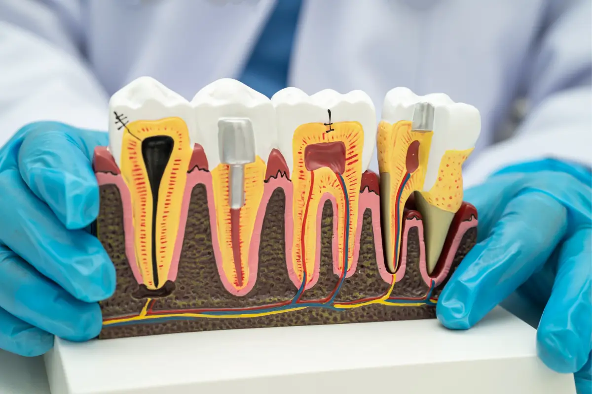 Cross section of teeth and gums